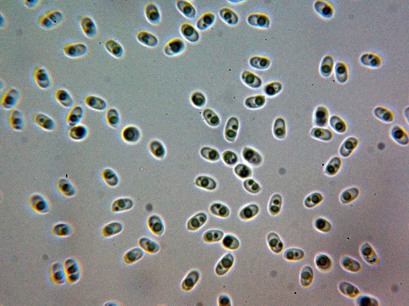 Aiuta con un corticale hydnoide